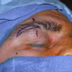 Illustration for article titled How MMA Fighters Use Plastic Surgery to Bleed Less